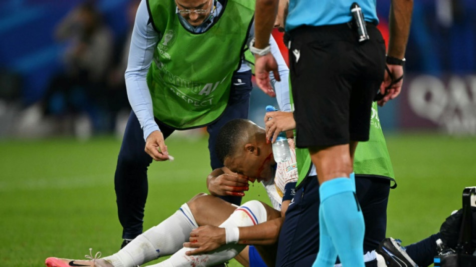 France's Mbappe breaks nose at Euro 2024