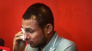 Malaysia footballer badly hurt in acid attack pledges to play again