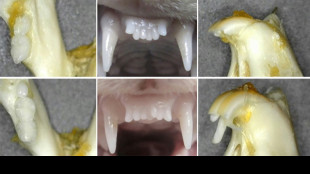 Japanese researchers test pioneering drug to regrow teeth