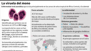 La OMS descarta por ahora temores de una pandemia por la viruela del mono