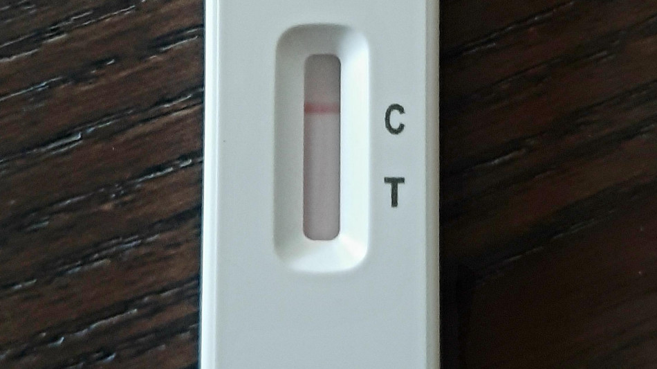 Covid: altri microbi proteggono i bambini da forme gravi