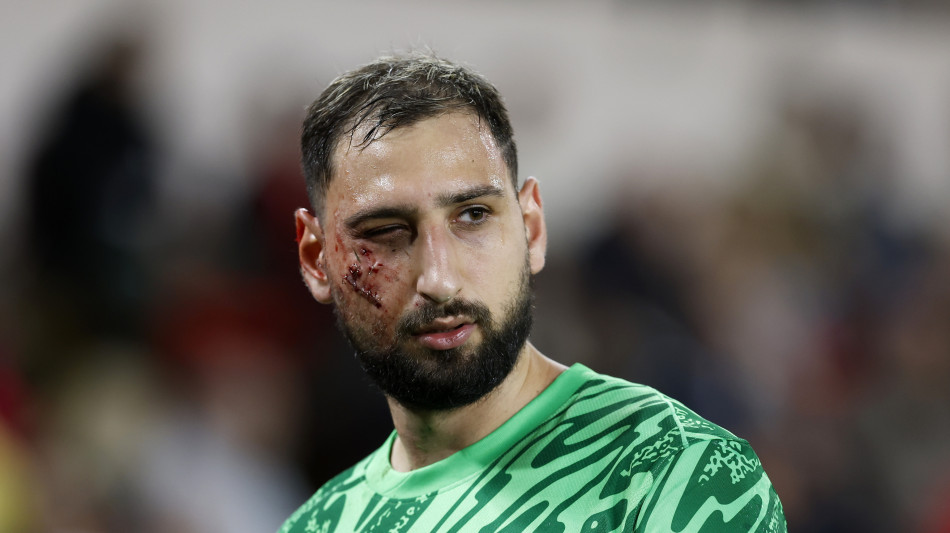 Tremendo scontro con Singo, infortunio Donnarumma in Monaco-Psg